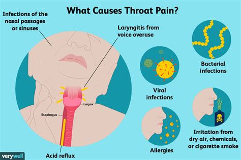 throat pain  treatment      doctor