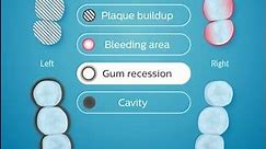 Sonicare App focus areas | Philips | Sonic electric toothbrush