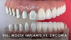 The Differences Between Full Mouth Implants and Zirconia