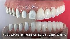 The Differences Between Full Mouth Implants and Zirconia