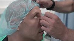 Zabieg septoplastyki (korekcji krzywej przegrody nosa) w Centrum Medycznym MML - Damian Janikowski