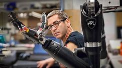 Will a robotic arm ever have the full functionality of a human limb?