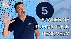 Tummy Tuck Recovery - 5 stages