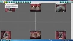DEXIS™ Imaging Suite Toolbar Overview - Part One