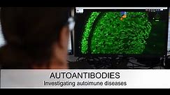 Autoantibodies- investigating autoimmune diseases