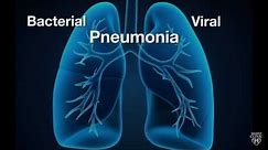 Mayo Clinic Minute: Is pneumonia bacterial or viral?