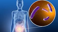 Clostridium difficile : comment se transmet cette maladie ?