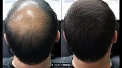 THICK FIBER | Hair Building Fibers is a hair loss concealer fiber. Cover up Bald patches