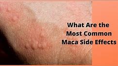 What Are the Most Common Maca Side Effects