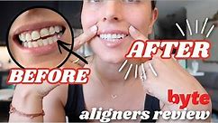 BYTE ALIGNERS REVIEW | progress + byte aligners before & after