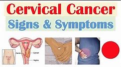 Cervical Cancer Signs & Symptoms (& Why They Occur)