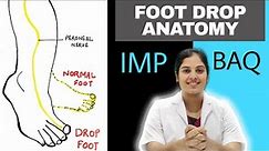 Foot Drop and Peroneal Nerve injury | Case presentation and management | Medseed MBBS