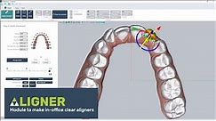 Clear aligner software: thermoforming or direct printing