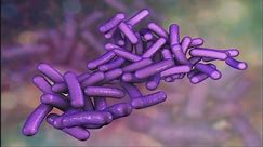 What doctors say you need to know about Shigella, the drug-resistant stomach bug causing concerns