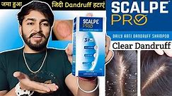 Scalpe Pro Anti Dandruff Shampoo Review | Daily Anti Dandruff Shampoo