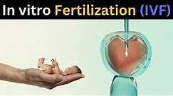 What is In vitro fertilization ? || how test tube babies are produced! | 3d animation