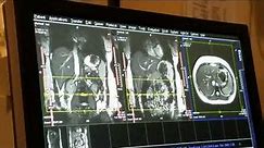 School of Medical Imaging MRI Lab - Abdomen Part I