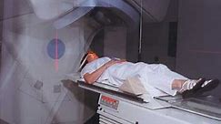 Intensity-Modulated Radiation Therapy (IMRT)