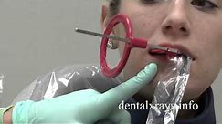 Premolar bitewing positioning tips for dental x-rays