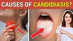 10 Shocking 😳 Causes of Candidiasis that you Might don't Know! - Credihealth