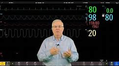 Philips IntelliVue Patient Monitoring - #5 - Changing Alarm Limits