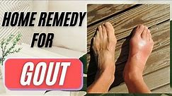 Home Remedy For Gout Attack | Gout Treatment At Home | 2020 American Rheumatology Guidelines