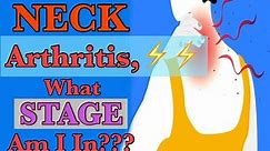 Neck Arthritis (2024) | Stages of Degeneration | Dr. Frank Altenrath Chiropractor in Cresskill, N.J.