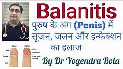 Balanitis - Infection of Penis and Foreskin | kee Complete Information.| Dr Yogendra bola in hindi