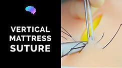 Vertical Mattress Suture - OSCE Guide | UKMLA | CPSA