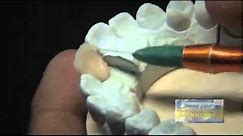 Resina Dental Nano Hybrid Prime Dent Dental Miami Usa