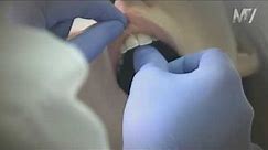 Nitkowanie zębów - jak używać nici dentystycznej