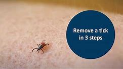 Remove a tick in 3 steps