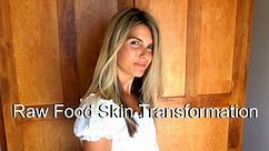 Raw Food Skin Before & After 801010 Transformation (photos)