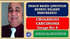 CHOLANGIOCARCINOMA - Heapato Biliary Pancreatic - Image8