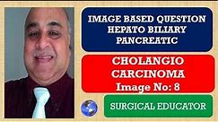 CHOLANGIOCARCINOMA - Heapato Biliary Pancreatic - Image8