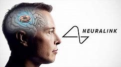 Elon Musk's Neuralink Brain Chip Gets Human Trial Approval from FDA
