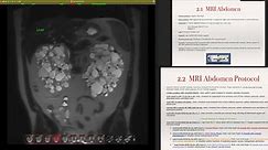 How to Scan an MRI Abdomen