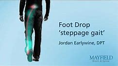 Foot Drop "steppage gait"