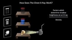 How to Interpret a Chest X-Ray (Lesson 1 - An Introduction)