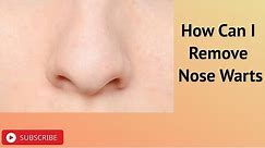 How Can I Remove Nose Warts