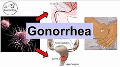 Gonorrhea (Neisseria Gonorrhea) | Pathophysiology, Symptoms & Complications, Diagnosis, Treatment
