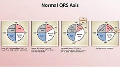 Intro to EKG Interpretation - Rate and Axis