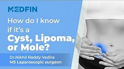 Cyst, Lipoma & Mole: What’s the Difference?