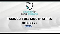 Taking an FMX with Dexis Software (Full Mouth Series X-rays)