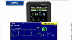 Philips IntelliVue MX40 Patient Monitor - Alarms