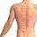 Acupuncture Lower Back