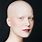 Alopecia Bald