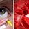 Anemia Eyes