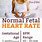 Baby Heart Rate Gender
