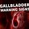 Bad Gallbladder Symptoms